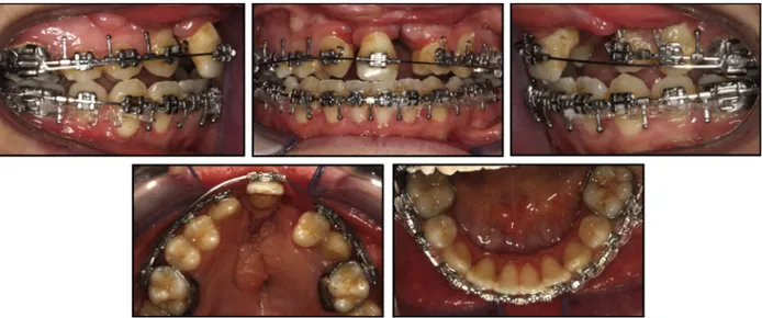 Fig 5. Preoperative intraoral photographs.