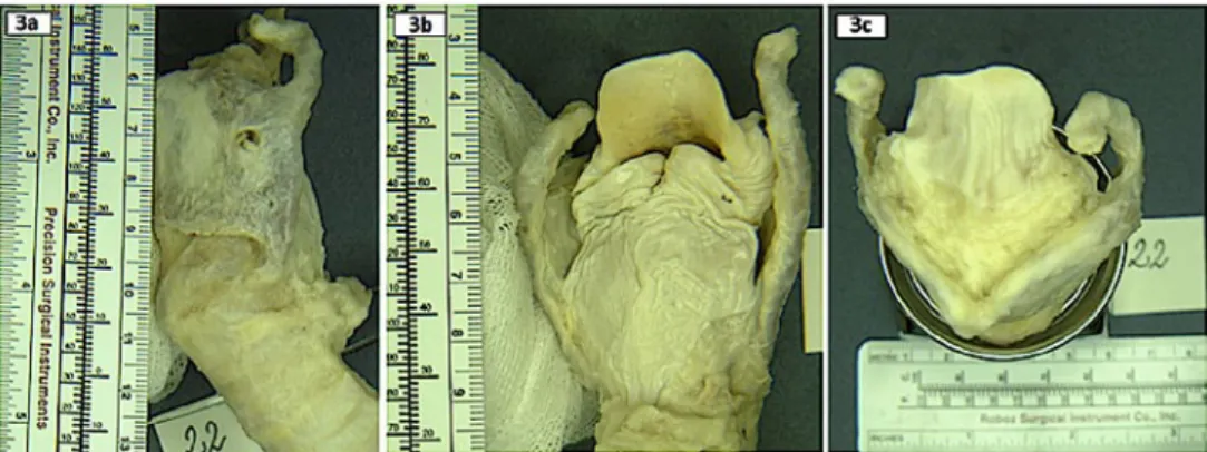 Table 3. Measurements from lateral view, in both sexes together (N = 50; data in mm; SD: standard devia- devia-tion)