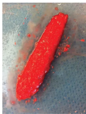 Fig. 2 Application of blood to the bone dust–diced-cartilage mixture.