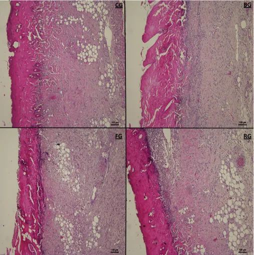 Fig. 7. Microscopic examination of granulation tissue thickness, angiogenesis and epidermal-dermal regeneration on control (CG), blank in situ gel (BG), FA (2%) in situ gel (FG) and Fucidin ® groups (RG) by histological wound healing scores among.