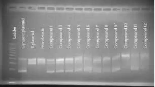 Figure 3: Results of gel electrophoresis with 1 mg/100µL (w/v) dilution super-coiled (Gyrase+r.