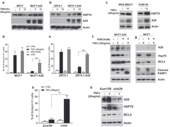 Fig. 3 TNF α-induced post-translational upregulation of HSP70 is A20 dependent. a, b Parental and A20 overexpressing MCF7 and ZR75-1 cells were treated with TNF α (20 ng/ml) for 2 and 12 h and examined the protein expression of HSP70 and A20