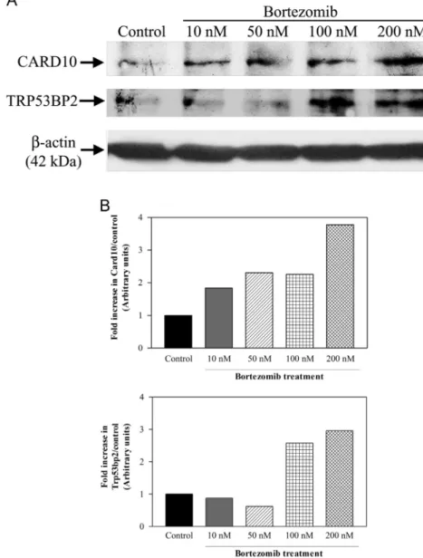 Fig. 1. (A) Examination of Card10 and Trp53bp2 proteins by Western blotting. 4T1 cells were treated with various concentrations of bortezomib (10, 50, 100 and 200 nM) for 24 h
