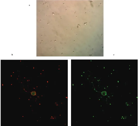 Figure 1. Imaging of cultured primary spinal motor neurons. (a) Light microscopy showing a spinal motor neuron with its prominent  growth cone (40X); (b) Laser confocal microscopy imaging of spinal motor neurons with anti-ChAT antibody labeling (40X with o