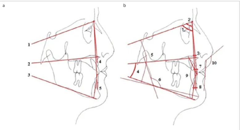 Figure 1. a, b. (a): 1. SN plane: Plane is passing through Sella and Nasion points. 2