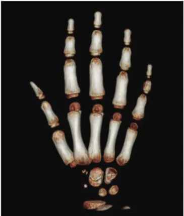 Figure 4: Sagittal CT image of the wrist 