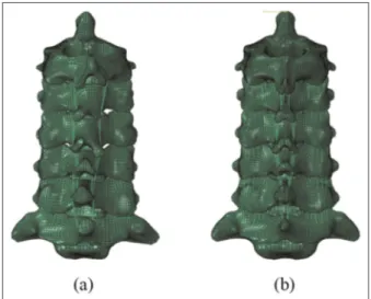 Figure 2. Circular mesh pattern, which was implemented on the C4 vertebral body: (a) ASYM model and (b) SYM model.