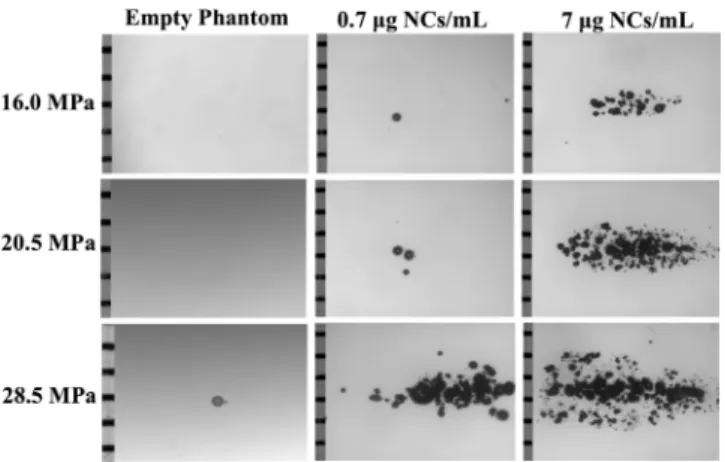 Figure 8. Bubble cloud was generated using NCs as the histotripsy agent in agarose tissue phantoms exposed to histotripsy pulses at peak negative pressures of 16.0, 20.5, and 28.5 MPa