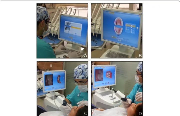 Figure 2 Digital impression technique. A) Entering patient information, B) Laboratory prescription, C) Upper and lower arches scanning, D) Bite scanning.