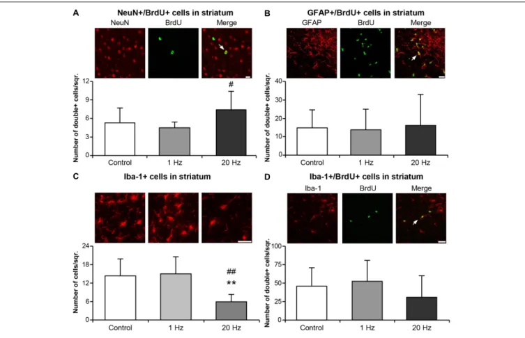 FIGURE 7 | Neurogenesis was induced and Iba-1+ microglial activation was inhibited by 20 Hz rTMS