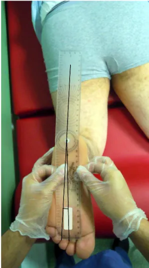 Fig. 1 The clinical measurement of thigh–foot angle. With the patient in a prone position, the ankle was put into a neutral position with the knee in 908 flexion