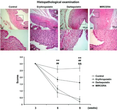 Figure 2. Histopathologic examination. Histopathologic  examinations revealed that MIRCERA was less effective  on the development of endometrial foci as compared with  erythropoietin and darbepoietin