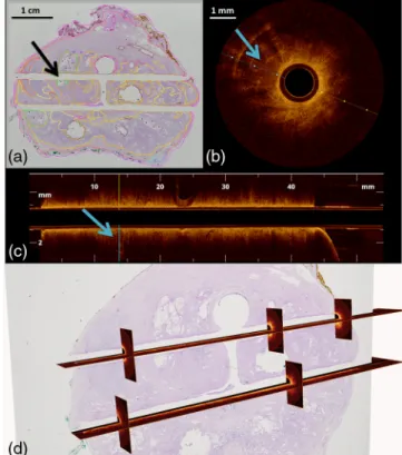 Fig. 3 Correlation of histology and OCT. (a) Digitized H&amp;E-stained whole mount slide of the prostate