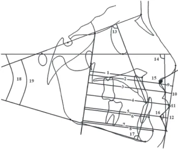 Figure 3  Lines and linear and angular measurements used in the study: 