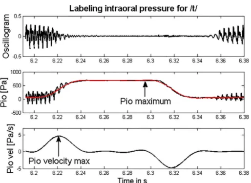 Fig. 3. Upper track: Acoustic signal; middle track: intraoral pressure (raw data in black and ﬁltered data in grey (colour online), annotation of intraoral pressure maximum (Pio Max);