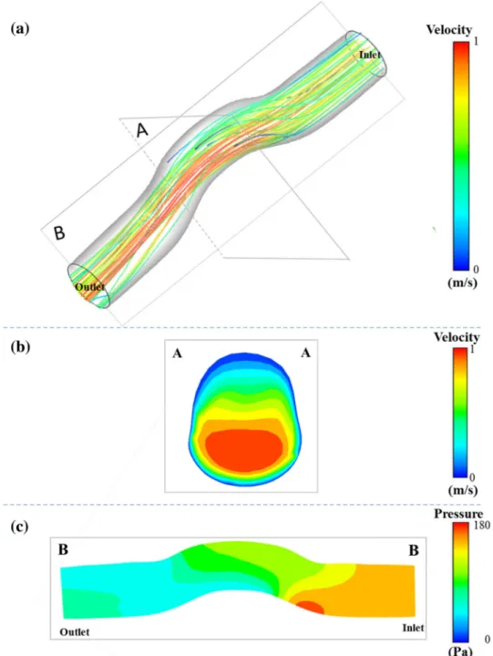 FIGURE 8. Patch hemodynamics quantified through the computational fluid dynamics analysis to compute pressure drop values.