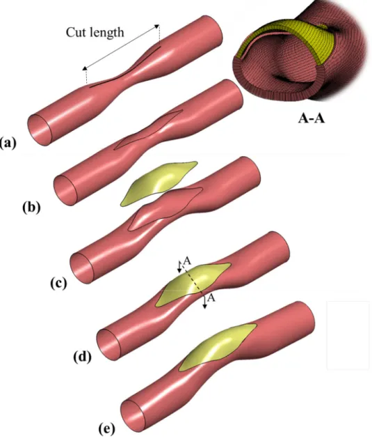FIGURE 1. An idealized main pulmonary artery having symmetric stenosis leading to an asymmetric post-operative conduit after patch repair