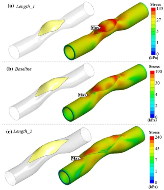 Figure 3 shows the 3D post-operative shape of de- de-signed patches for the cases in Length group