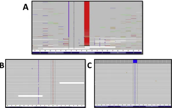 Fig. 11 e SLC19A3 mutation was found. A: Patient 1-2 sequence result. B: Patient 3-4 sequence result