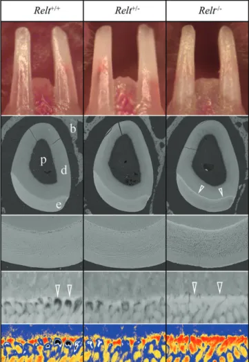 FIGURE 4 Incisors of 2-week-old (D14) Relt mice. Three genotypes were compared: wild-type (Relt +/+ ; left), heterozygous (Relt +/ − ; center) and homozygous (Relt −/− ; right)