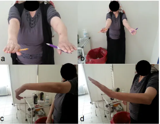 Fig. 3. Clinical pictures which show patient’s functional status at 3 months control.
