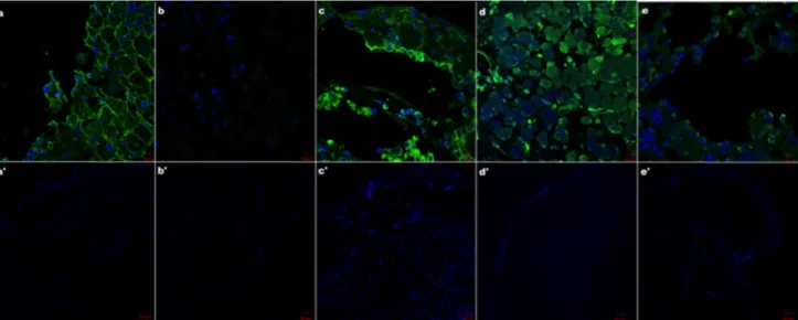 Fig. 3. Immunohistochemical staining of Tubulin after fixation with NBF, Alcoholic Formaline, AFA, Bouin’s, Carnoy’s and Clarke’s solutions.40X magnification, Bar=10 µm (a,b,c,d,e) and 10X magnification, Bar=50 µm (a,b,c,d,e) (blue; DAPI green; Tubulin).