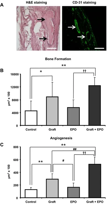 Fig. 2. A) Representative images of Hematoxylin &amp;Eosin staining for evaluation of bone formation and CD 31 immunohistochemical staining for evaluation of angiogenesis (Bars ¼ 100 m m)