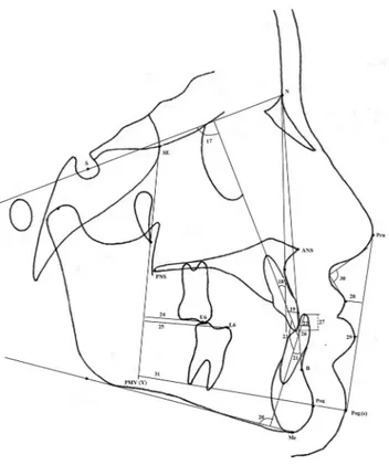 Figure  4  Dental and soft tissue measurements used in the study: (17)  U1–SN (18) U1–NA degree; (19) U1–NA mm; (20) IMPA; (21) L1–