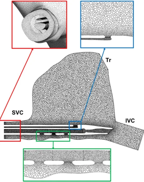 FIG. 2. Cut-plane snapshots from the computational multi-domain mesh used in the flow simulation