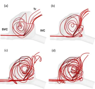 FIG. 6. Velocity streamlines showing the direction of jet from the infusion hole at different inflow velocities