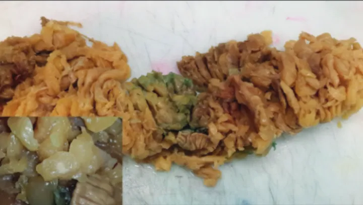 Figure 1: Residual small lymph nodes can be seen easily after ethanol  fixation. Inset: Closer view of the lymph node