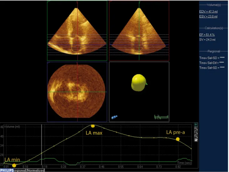 Fig. 1 An example of left atrial volume quantification by real-time 3-dimensional echocardiography