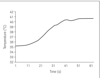 Fig 4    Representative temperature record during crown sectioning  with diamond bur and without irrigation for 1 minute.