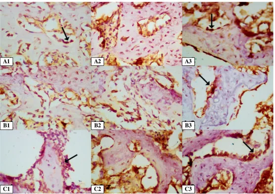 Figure 4. Immunohistochemical expression of TGF-b, VEGF and b-catenin around the trabeculae in the fracture area