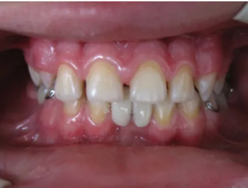 Fig. 5 Intraoral view after treatment