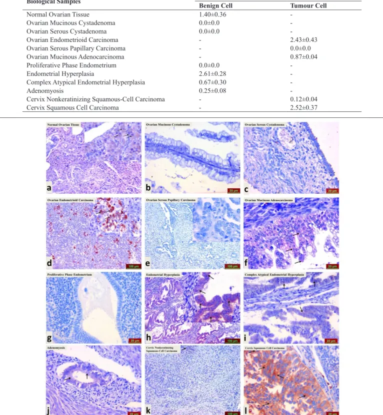 Figure 2. Immunoreactivity of irisin in human genital tissues with and without genital cancer and endometrium tissues