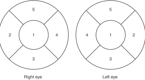 Table 3. Treatment response53 421Right eye 53 241Left eye