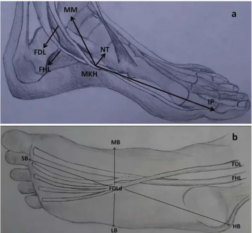 Fig. 1. The illustrations: 1a shows the distance of MKH to medial malleolus (MM), navicular tuberosity (NT) and ﬁrst interphalangeal joint (IP)