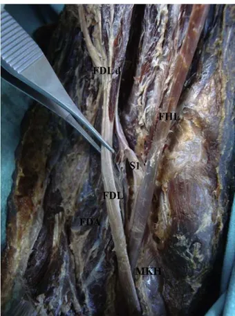 Fig. 8. The photograph shows FDA innervation and attachments of FDA to lateral margin of FDL