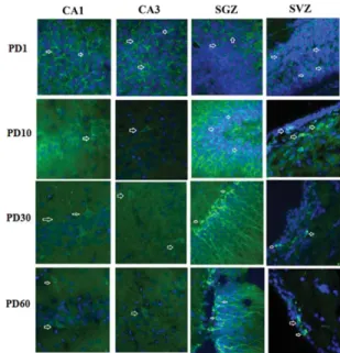 Figure 5 Comparison of mean total neuron numbers (6SEM) within hippocampal CA1, CA2 1 CA3, and DG regions in fetal alcohol (A) and control (IC and C) rat pups at different postnatal ages: PD1, PD10, PD30, and PD60, respectively