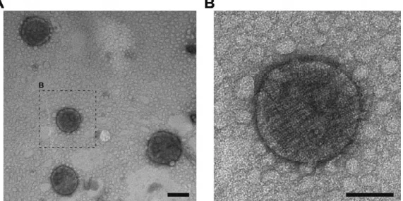 Fig.  (3).  (A)  TEM  images  of  emulsomes  coated  with  rSbpA-GG  (i.e.,  S-layer  proteins  fused  with  double  protein  G  domains);  (B)  Closer  view to one rSbpA-GG coated emulsome