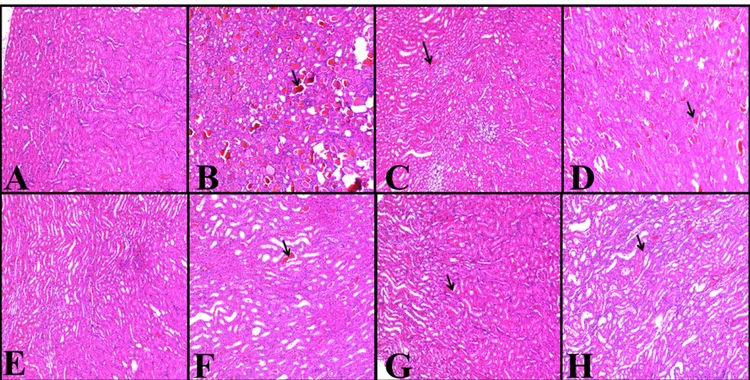 Figure 11. (a –h) Haematoxylin and eosin results in rats’ kidney tissues; magnification 1003