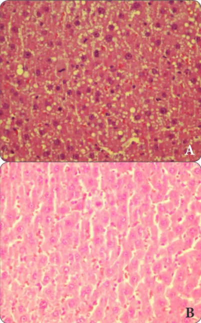 FIGURE 1. A) Macro and microvesicular fattening at liver, expansion at sinusoids and  a great number of mitosis H/E X400 (GLP KC 1)