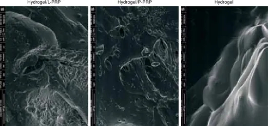 Figure 3. Environmental scanning electron microscope images  of chondrocytes.  P-PRP: Pure platelet-rich plasma; L-PRP:  Leukocyte-platelet-rich plasma.