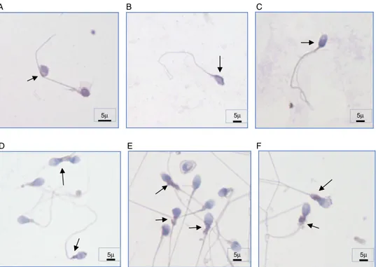 Figure 2. Subcellular localization of caspase-3 in human spermatozoa of different individuals