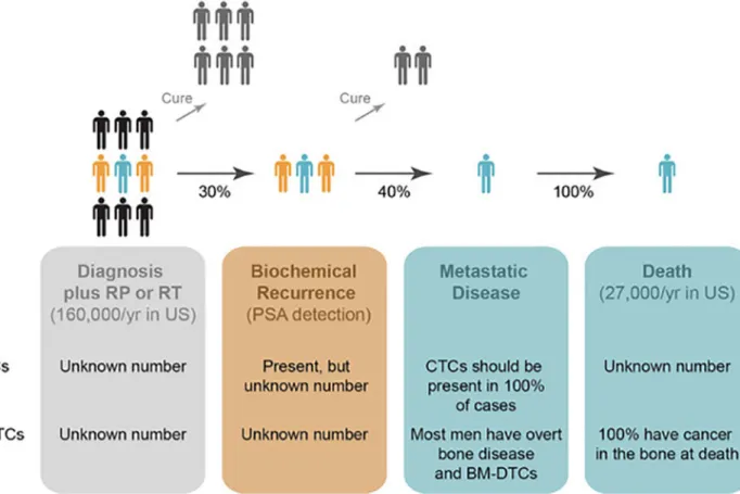 Figure 1. Timing of tumor dissemination through prostate cancer progression