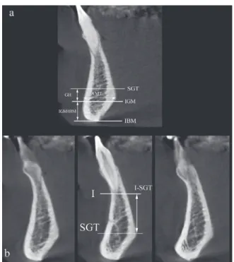 Fig. 1    (a) CBCT scan showing the parameters evaluated: thick- thick-ness of the anterior mandible (AMT), genial tubercle height (GH; 
