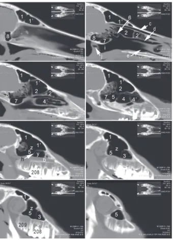 Fig. 3.  Reformatted dorsal plane images (dorsoventral direction,  interval 8 mm), foal 3 (11 weeks)