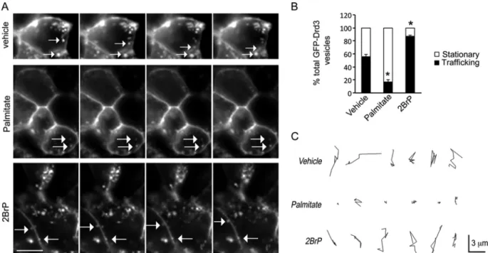 FIG 7 Description of a GIPC1 mutant that cannot bind to Drd3. (A) Sche- Sche-matic representation of GIPC1 and mutant lacking the ACP domain