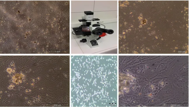 Fig. 4. Healthy and proliferating cells with 90% conﬂuence and cell count on Thoma counting chamber with trypan blue.